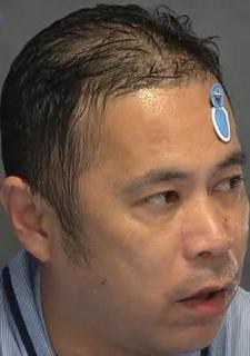岡村 ハゲ.jpg